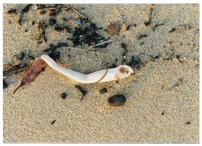 A digital image on metal from film. Ballerina's arm